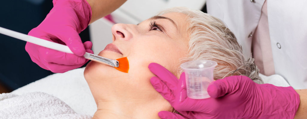 Medium Chemical Peels