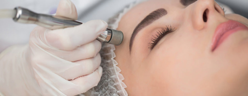 What is Diamond Microdermabrasion?