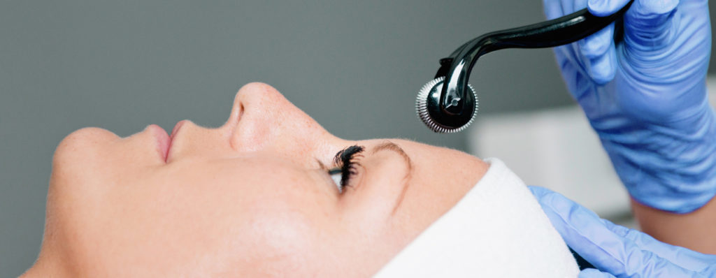 How does Microneedling work?